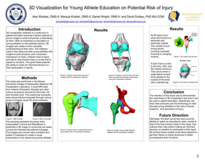 3D Visualization for Young Athlete Education on Potential Risk of Injury Miniature